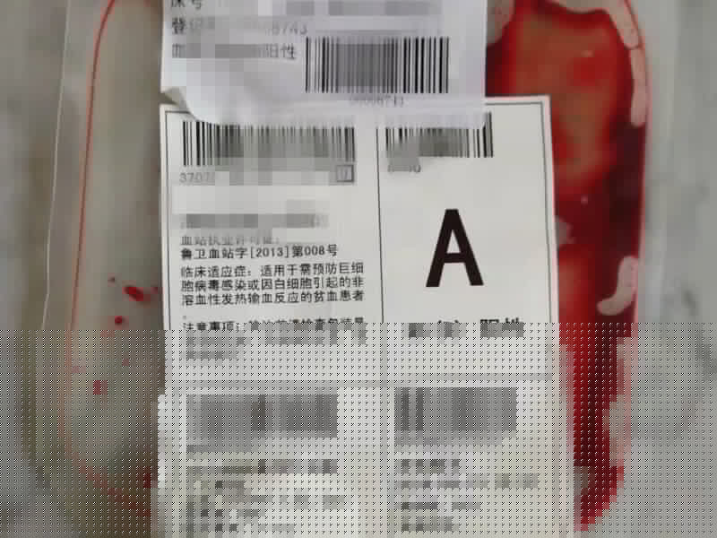 血袋不干胶标签